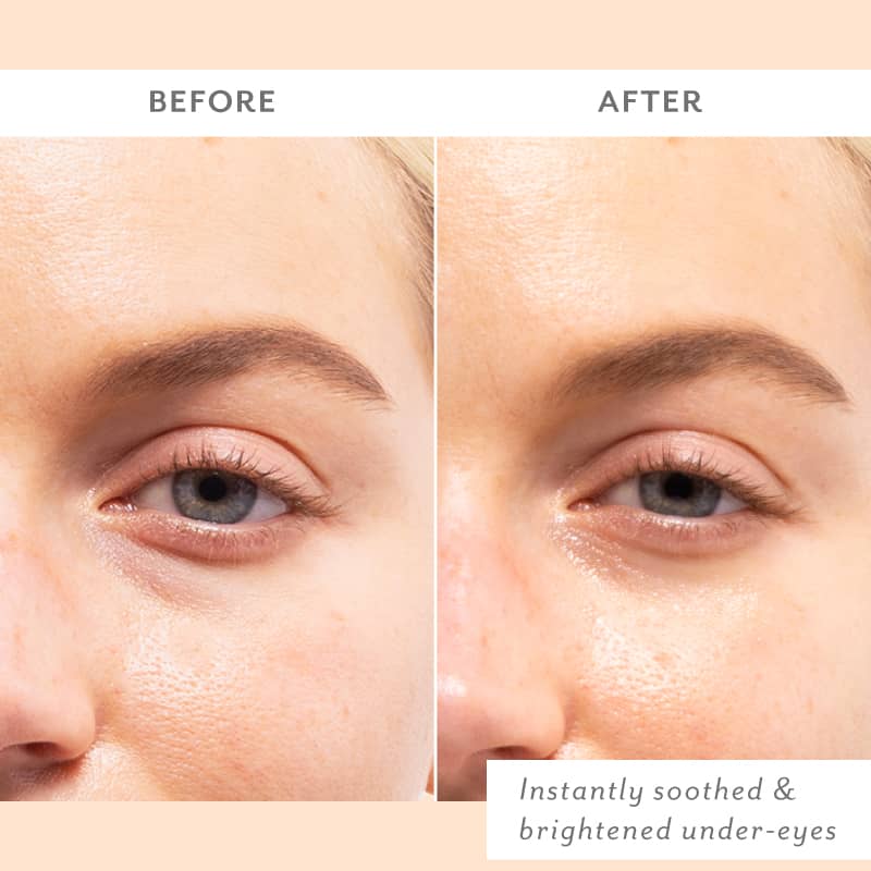 Skin Remedy | Soothing Eye Gels