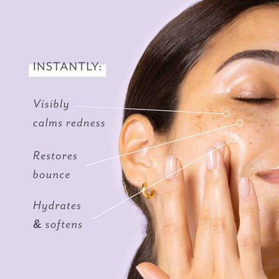 Skin Remedy | Barrier-Boosting Sheet Mask