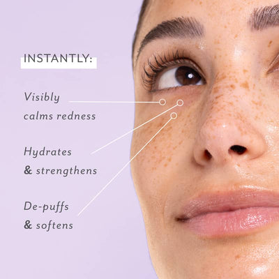Skin Remedy | Soothing Eye Gels